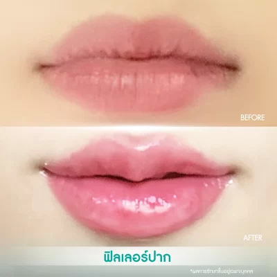 %e0%b8%9b%e0%b8%b2%e0%b8%81