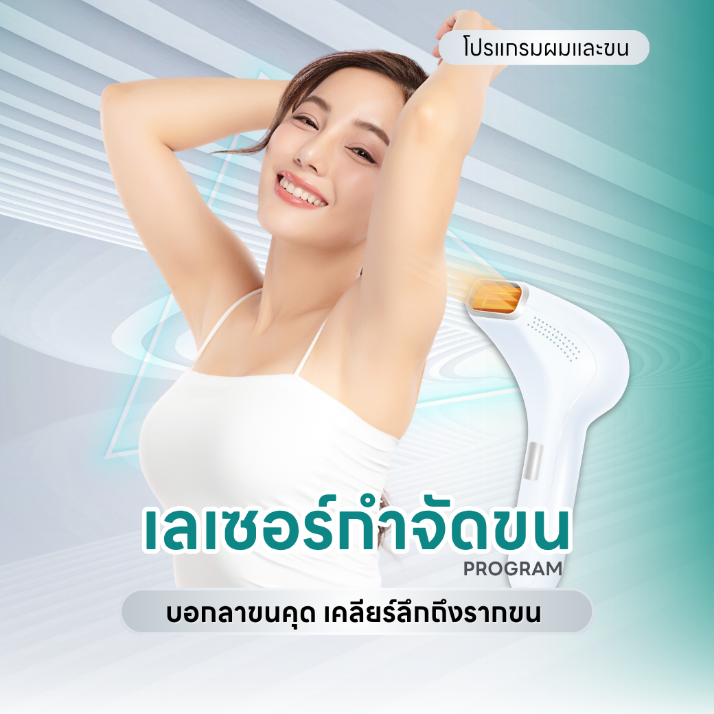 เลเซอร์กำจัดขน