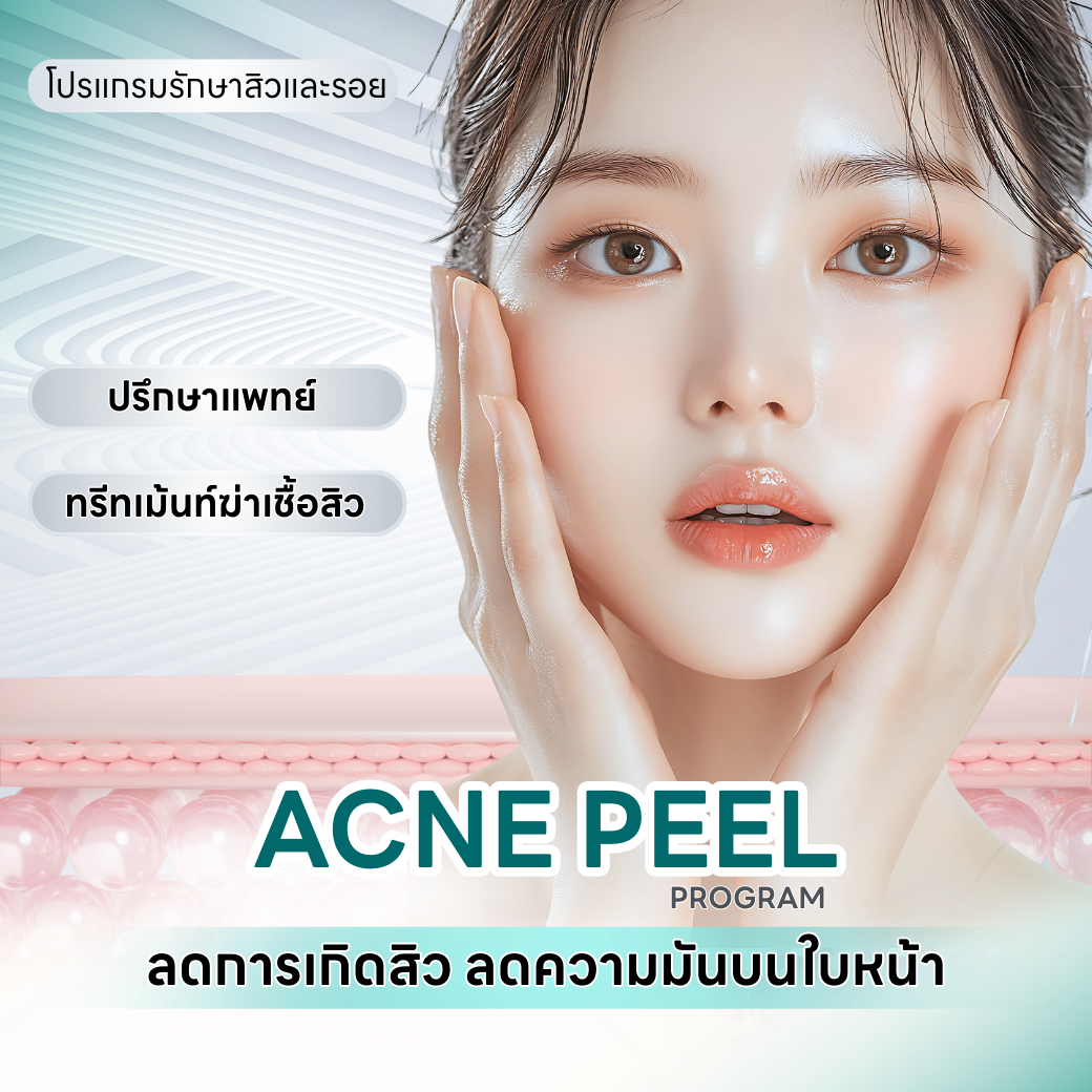 Acne Peel Program