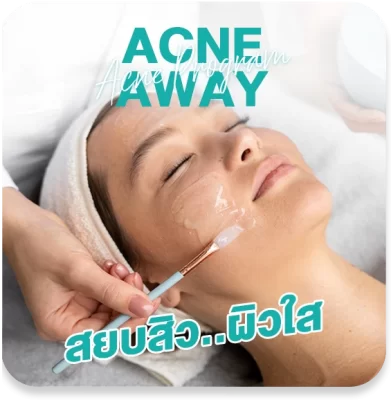acnet2