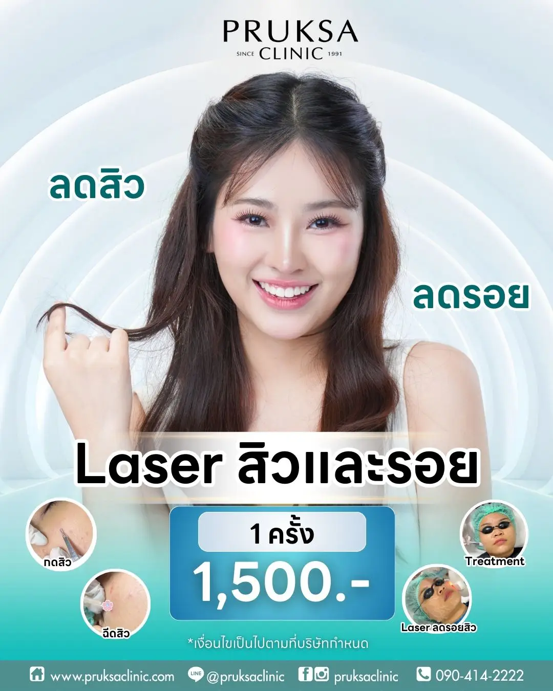 laser สิวและรอย