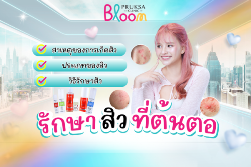รักษาสิวอย่างมีประสิทธิภาพ ด้วยการกำจัดต้นตอของสิว