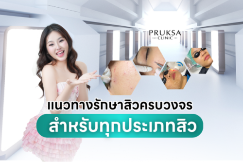 รวมมาให้แล้ว! แนวทางรักษาสิวครบวงจรสำหรับทุกประเภทสิว