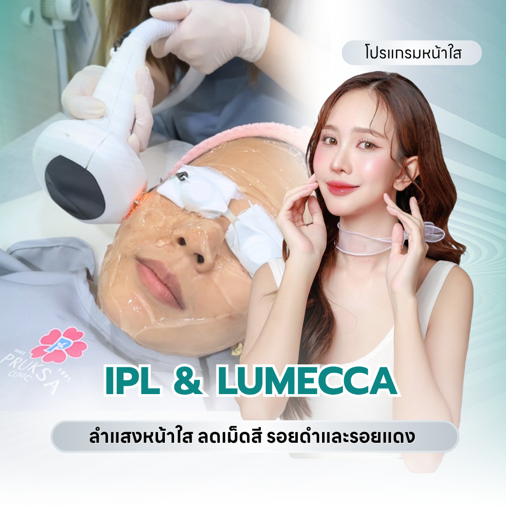 IPL & Lumecca ลำแสงหน้าใส ลดเม็ดสี รอยดำ รอยแดง