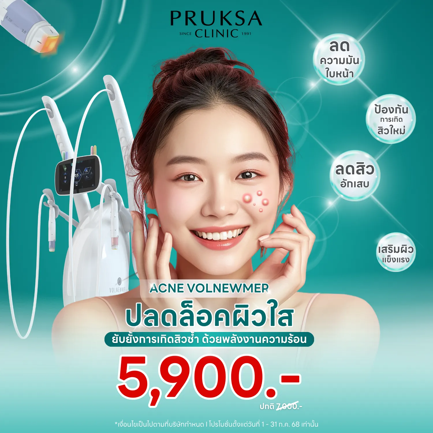 ปลดล็อคผิวใส ยับยั้งการเกิดสิวซ้ำ Acne Volnewmer✨