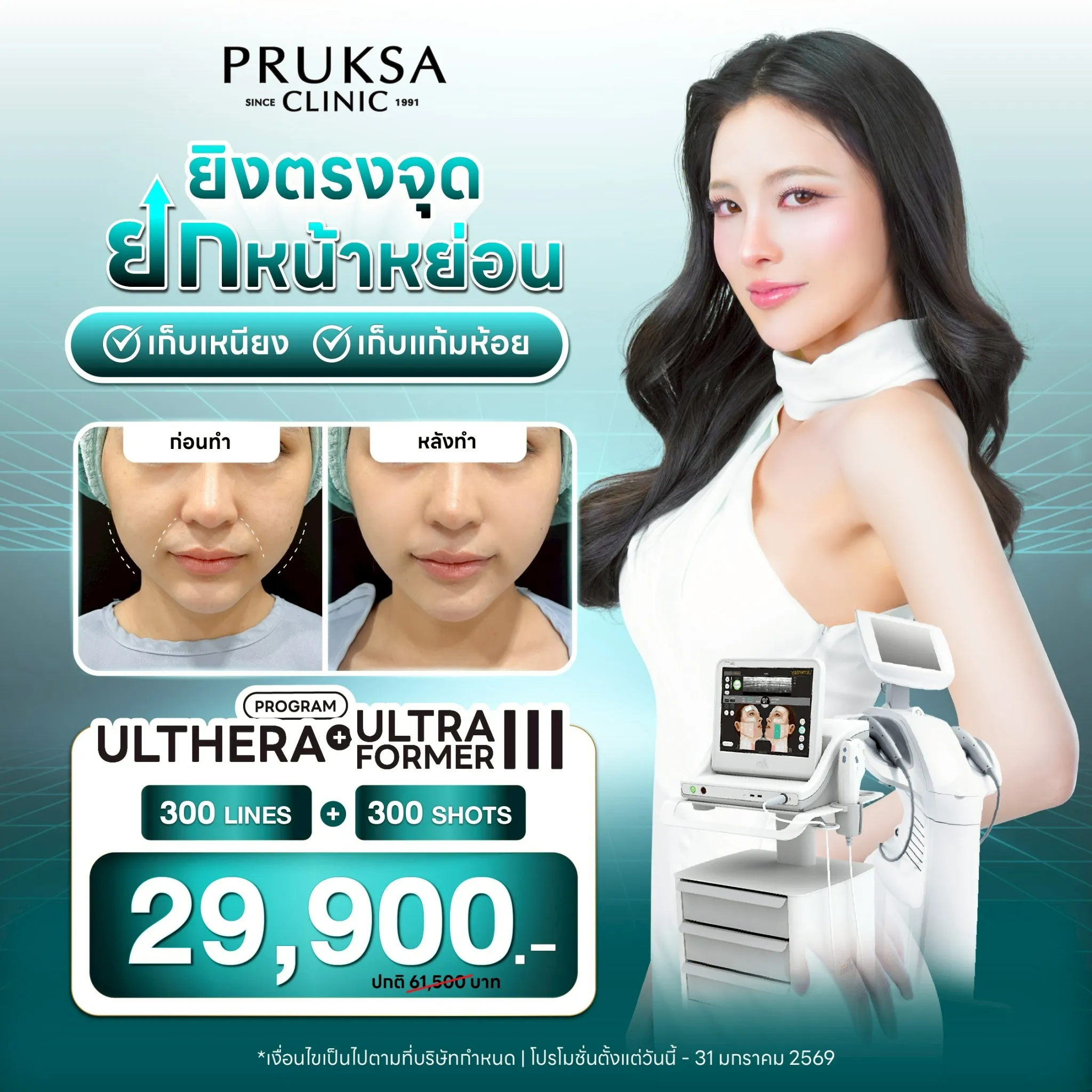 ✨ Combo Ulthera + Ultraformer III ยิงตรงจุด ยกหน้าหย่อน