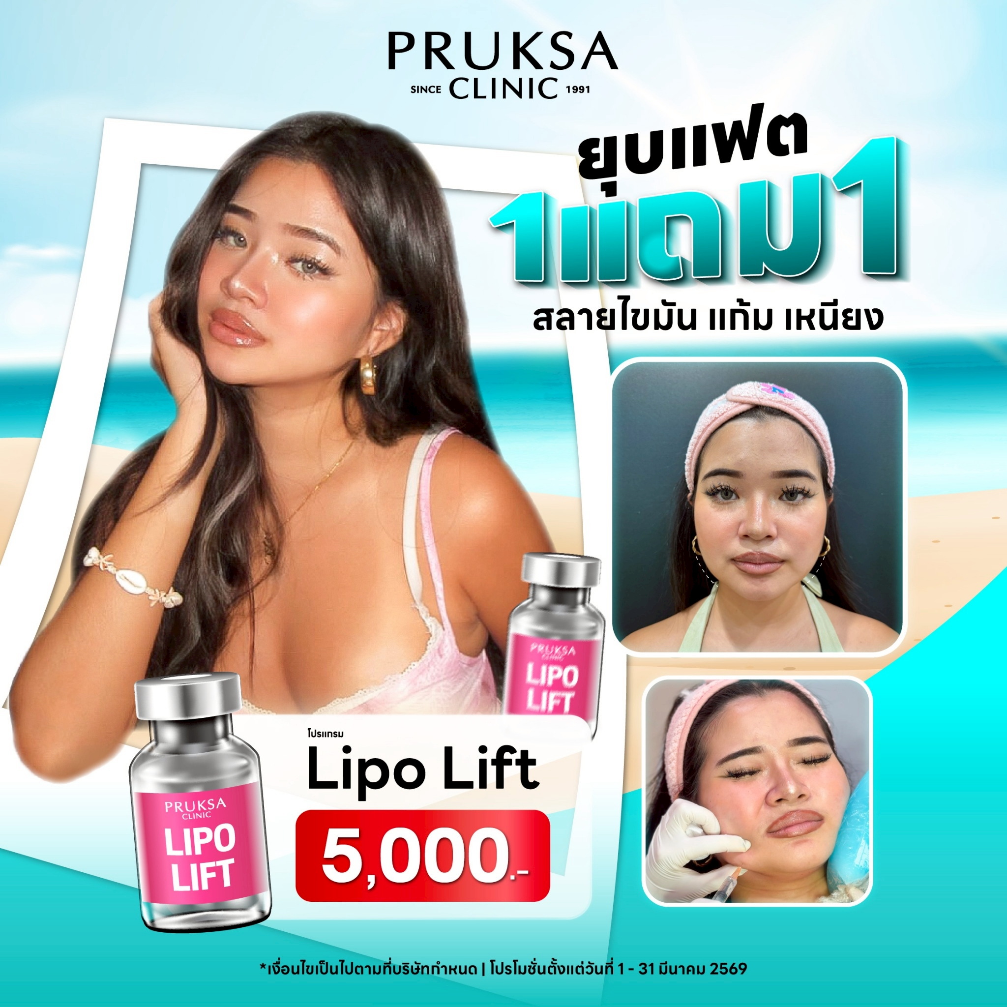 ✨โปรแกรม Lipo Lift สลายไขมันแก้ม เหนียง