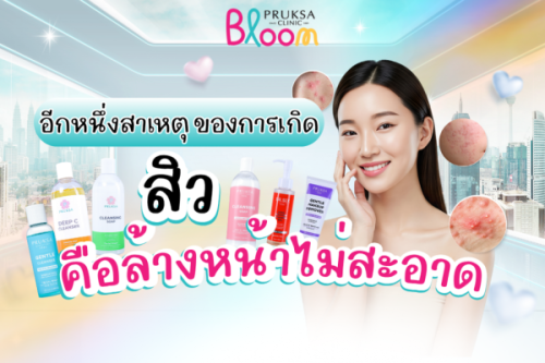 อีกหนึ่งสาเหตุของการเกิดสิว คือ “เช็ดหน้าไม่สะอาด”