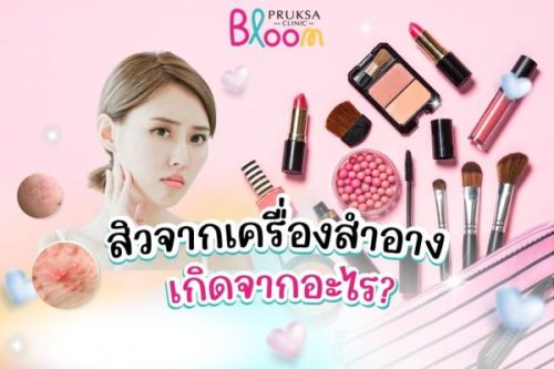 สิวขึ้นจากเครื่องสำอาง เกิดจากอะไร?