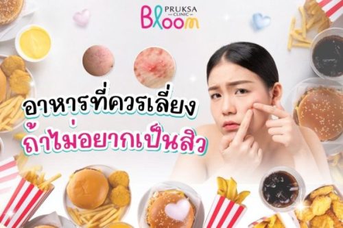อาหารที่ควรเลี่ยง ถ้าไม่อยากเป็นสิว